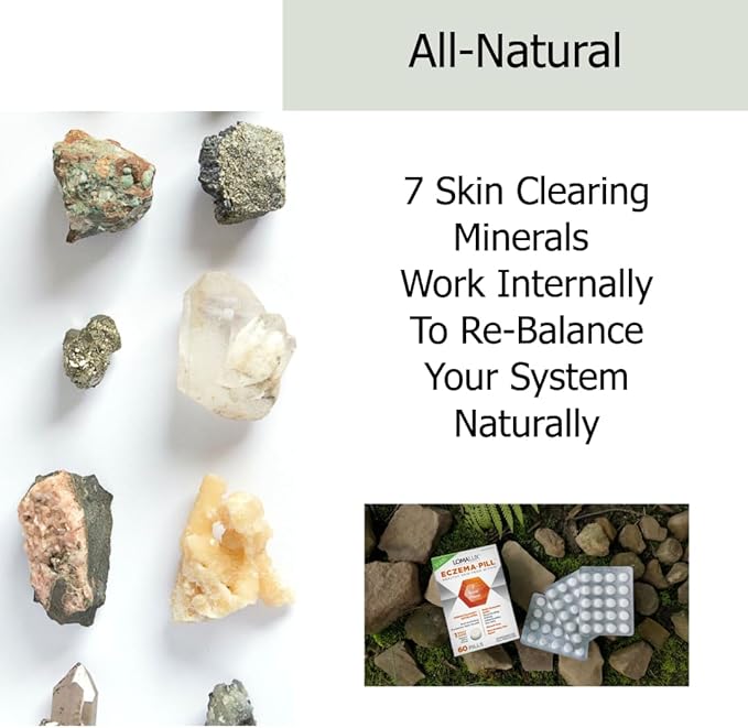 Eczema Pill – Natural Eczema Treatment – Dermatologist Developed – 7 All Natural Minerals Clear & Prevent Eczema Scaling, Rash, Itch, Inflamed Skin for Kids & Adults