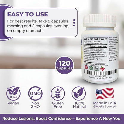 Psoriasis Support for Skin, 120 Herbal 6 Antioxidant
