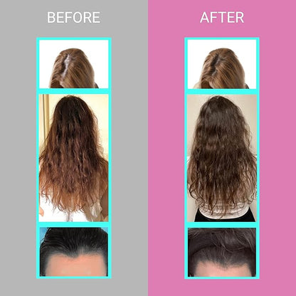 UpNourish Hair Growth Vitamins for Women 5000 mcg 90 ct