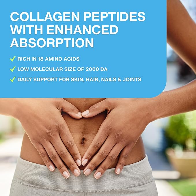 Mobility Hydrolyzed Collagen Peptides Supplement 28 Servings, 9.88 oz,